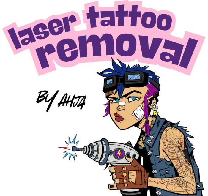 Tattoo removal by Ahja